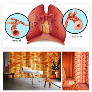 asthma